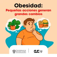 obesidad