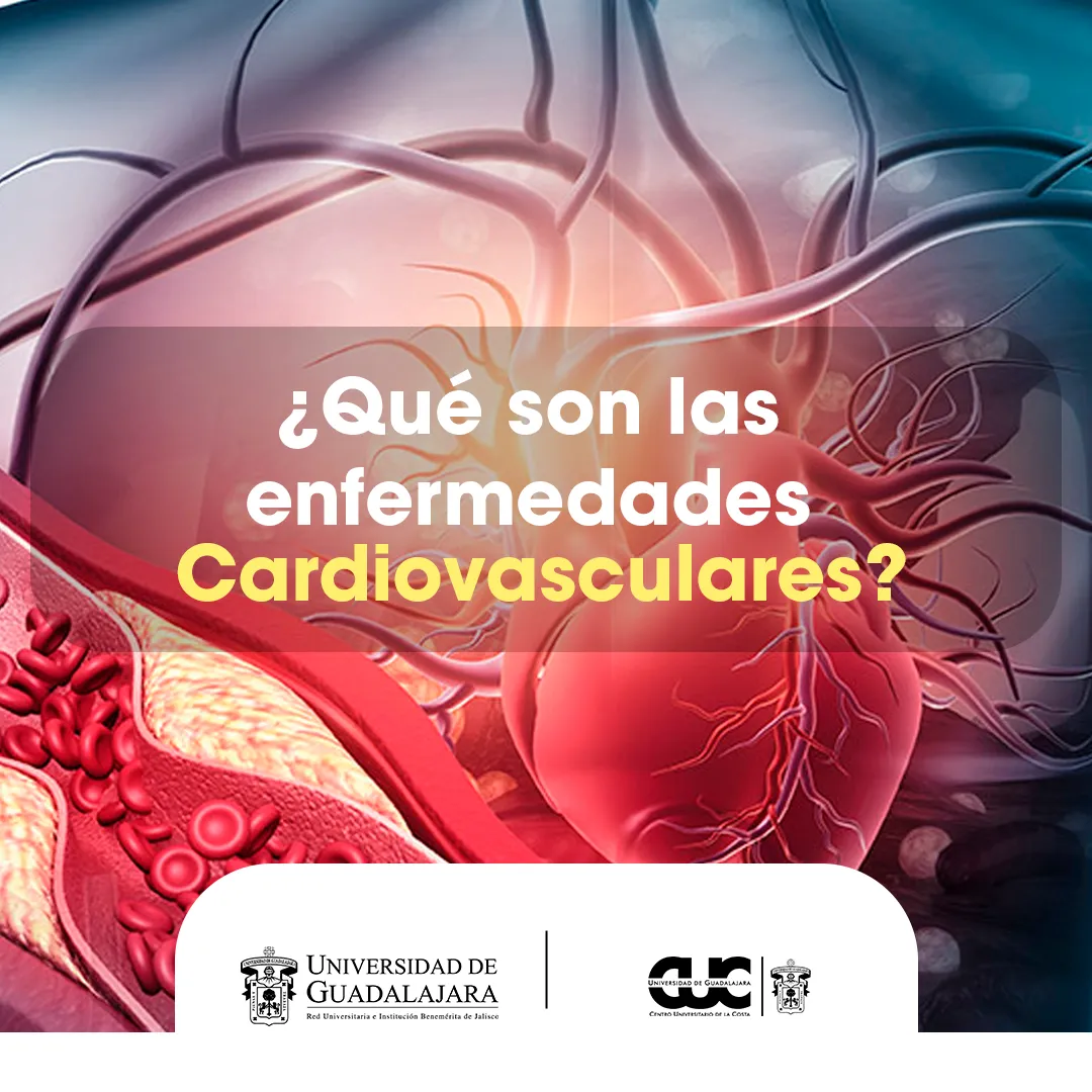 enfermedades cardiovasculares