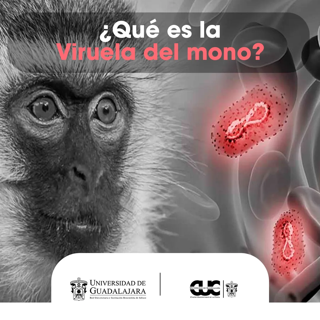viruela del mono
